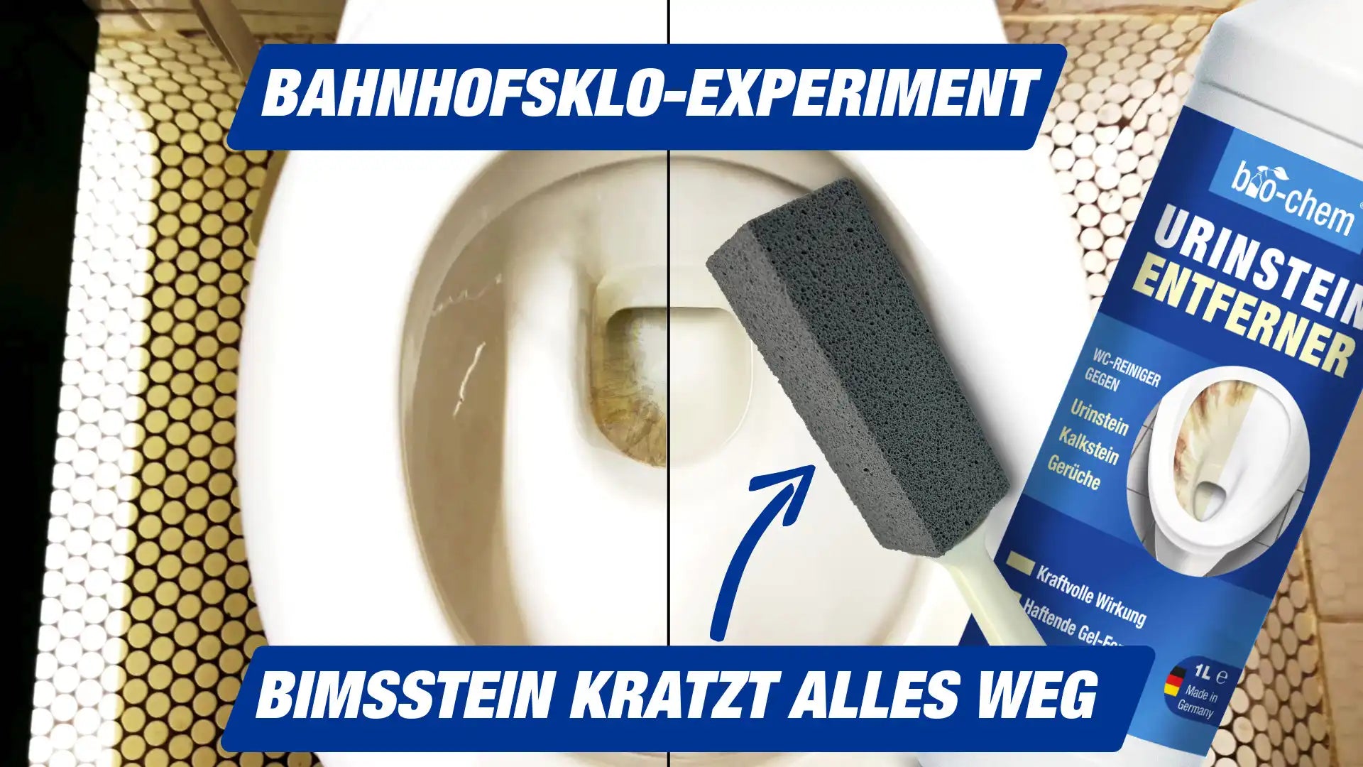 Urinstein entfernen